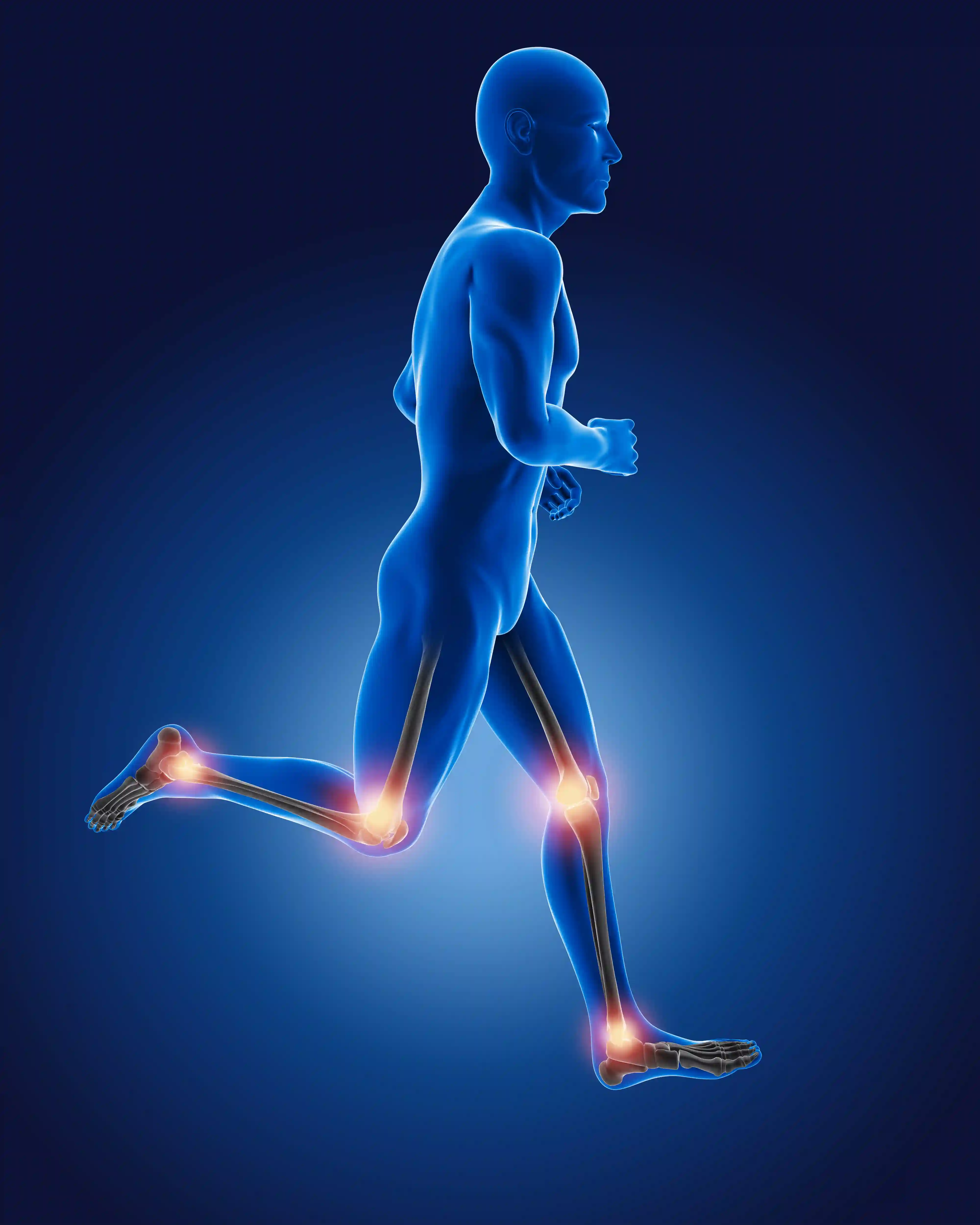 Revision Joint Replacement